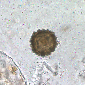 Case210_A.jpg Image A