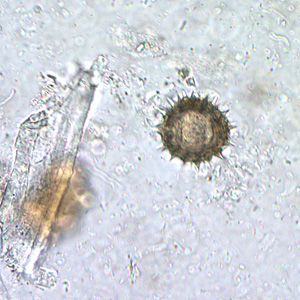 Case210_B.jpg Image B