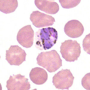 A 10-year-old boy from India was tested for malaria by blood smear examination. The commercial laboratory that reviewed the smears forwarded them, along with EDTA blood, to their state health department for consultation. 