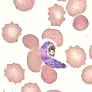 Case211_C.jpg Case211