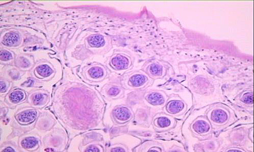 Case212_B.jpg Case212