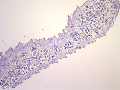 Case212_C.jpg Case212