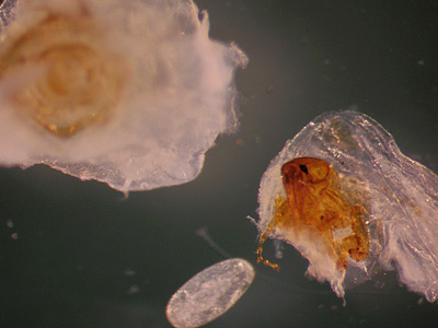 Case214_A.jpg Image A