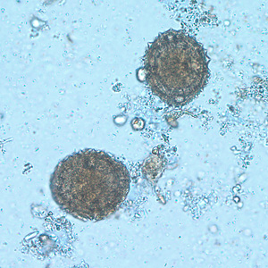 Case216_B.jpg Case216