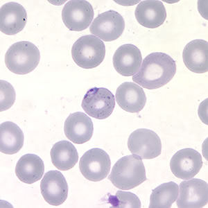 Case217_B.jpg Figure B