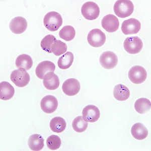 Case218_B.jpg Figure B