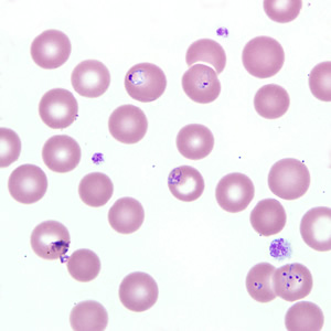 Case218_C.jpg Figure C