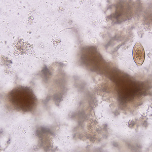 February - 2008 - Case #221 A survey was conducted to determine the prevalence of geohelminth infections in school-age children living in Haiti. The laboratory aspect of the survey consisted of processing stool specimens which were collected in 10% formalin.