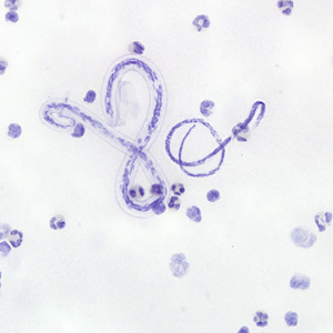 Images were taken from a thick blood smear stained with hematoxylin from an adult male from Cameroon. The following images, A-C were all captured from the same field of view. 