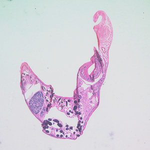 A 47-year-old male with travel history to the Galapagos Islands, Ecuador and Colombia presented to his health care provider with follicular conjunctivitis. A worm-like object measuring approximately 3.0 mm was removed from his eye and sent to a pathology laboratory for analysis. 