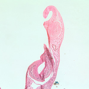 Case224_B.jpg Image B