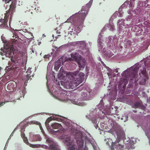 Case225_B.jpg Figure B