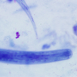 Case226_B.jpg Case226_B