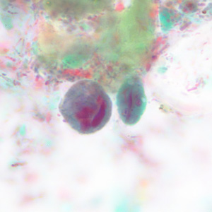 Case228_B.jpg Figure B