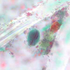 Case228_C.jpg Figure C