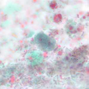 Case228_D.jpg Figure D