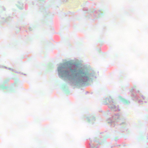 Case228_E.jpg Figure E