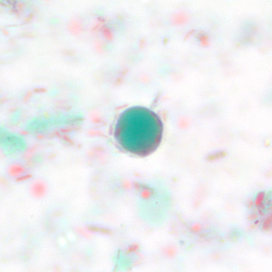 Case228_F.jpg Figure F