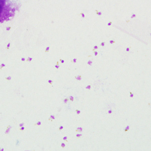 Wright-Giemsa stained blood smears and EDTA blood were sent for confirmatory diagnosis to the CDC from a Public Health Laboratory. The specimens were from a 46-year-old woman, but no travel history was available.