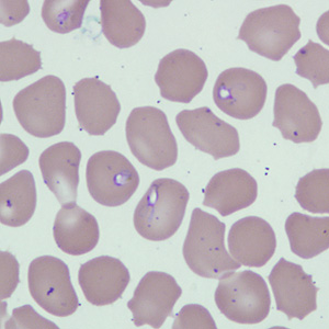 Case229_B.jpg Figure B