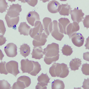 Case229_C.jpg Figure C