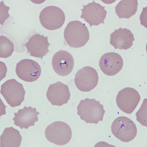 Case229_D.jpg Figure D