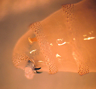 Case231_B.jpg Figure B