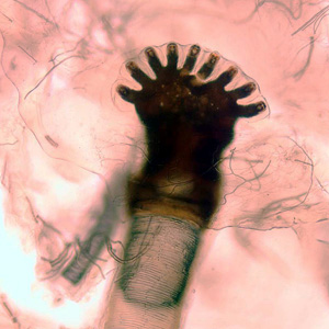 Case231_E.jpg Figure E