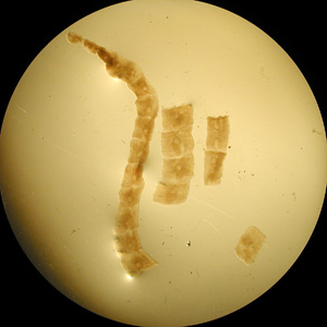 A study was conducted on herding dogs in a sheep-raising region of northeastern Arizona to determine the prevalence of Echinococcus granulosus. Public health officials wanted to determine the risk for hydatid cyst disease in the local people.