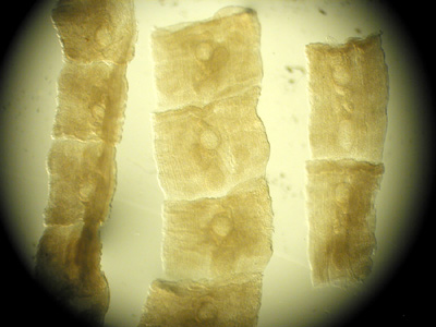 Case232_B.jpg Figure B