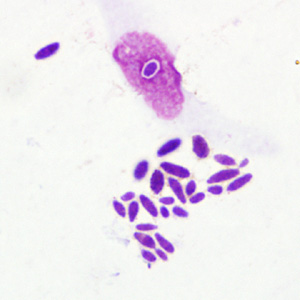 A 29 year-old man with travel history to Costa Rica, Belize, and Nicaragua developed an ulcerative lesion on his right foot. The lesion did not respond to over-the-counter medications so the patient went to his health care provider. 