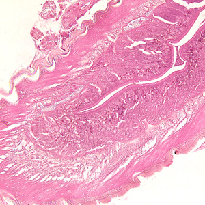 Case236_B.jpg Figure B