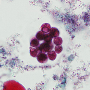 Case237_B.jpg Figure B