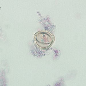 Case237_D.jpg Figure D