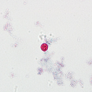 Case237_E.jpg Figure E