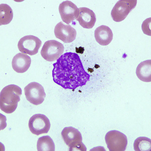 Case238_B.jpg Figure B