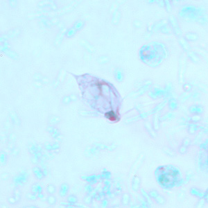 A 50-year-old man went to his health care provider after a week of intermittent diarrhea, cramps and nausea. Stool specimens were collected over three consecutive days and sent to the local public health laboratory for routine ova and parasite (O&P) work-up. 
