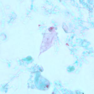 Case239_C.jpg Figure C