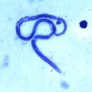 A 45-year-old immigrant from Mexico was admitted to the hospital after experiencing headaches, fever, pulmonary symptoms, and adenopathy. Because of his travel history, a blood specimen was collected and sent to Hematology for routine work-up, including blood parasitology. 