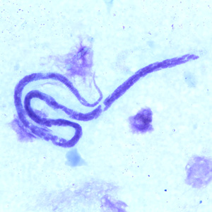 Case240_B.jpg Figure B