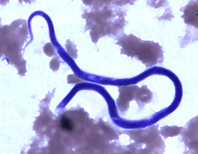Figure C