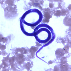 Figure D