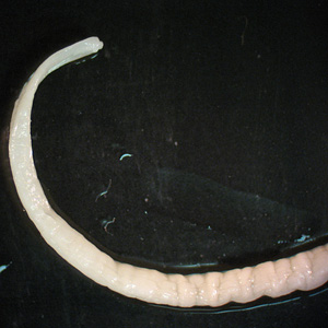 Case241_B.jpg Figure B