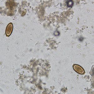 December - 2008 - Case #242 A nine-year-old boy from Central America, who had recently immigrated to the United States with his family, was taken to a local health facility with complaints of intestinal cramping and intermittent diarrhea.