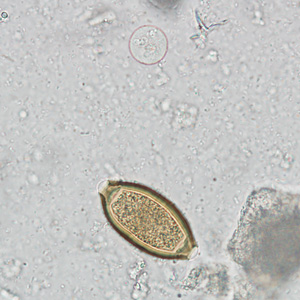 Case242_B.jpg Figure B