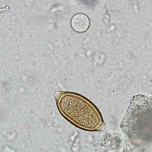 Case242_C.jpg Figure C