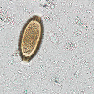 Case242_D.jpg Figure D