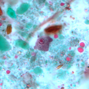 Case243_B.jpg Figure B