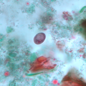 Case243_D.jpg Figure D