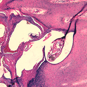 Case244_B.jpg Figure B